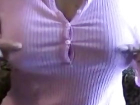ANE exhibiting nipples